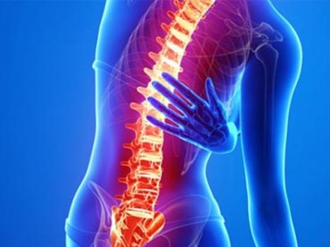 Hemangioma i ryggvirvelen (ryggraden): symptomer og behandling, fare, forårsaker Hemangioma i ryggraden og trening i treningsstudioet